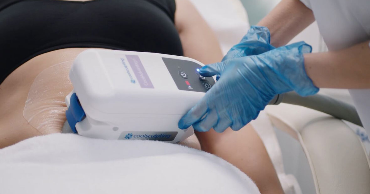 Coolsculpting